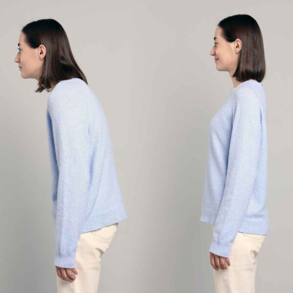 These 3 Postural Misalignments Increase Fracture Risk And Impair Physical Function These 3 Postural Misalignments Increase Fracture Risk And Impair Physical Function