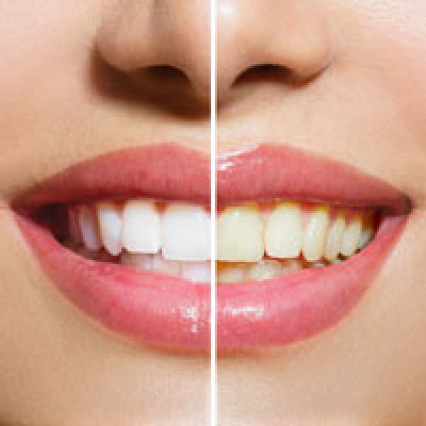 whiten teeth build bones